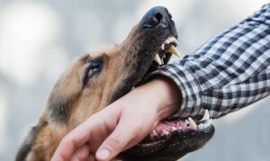 How McMinn Law Firm Can Help With Your Austin Dog Bite Case