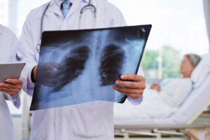 How Can McMinn Personal Injury Lawyers Help If You Suffered Chest Injuries in an Austin Car Accident?